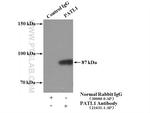 PATL1 Antibody in Immunoprecipitation (IP)