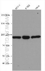 PATL1 Antibody in Western Blot (WB)