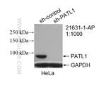PATL1 Antibody in Western Blot (WB)