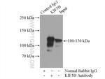 KIF5B Antibody in Immunoprecipitation (IP)