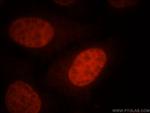 SMARCA4/BRG1 Polyclonal Antibody