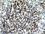 SMARCA4/BRG1 Antibody in Immunohistochemistry (Paraffin) (IHC (P))