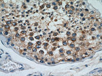 Cyclin B2 Antibody in Immunohistochemistry (Paraffin) (IHC (P))