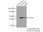 Cyclin B2 Antibody in Immunoprecipitation (IP)