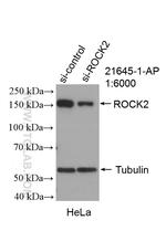 ROCK2(middle) Antibody in Western Blot (WB)
