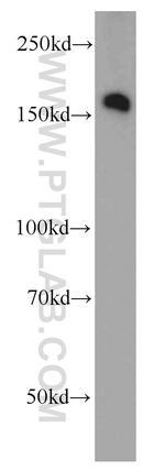 ROCK2(middle) Antibody in Western Blot (WB)