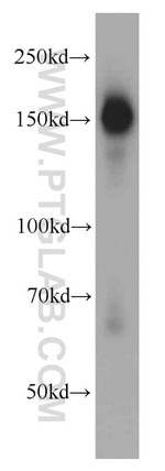 ROCK2(middle) Antibody in Western Blot (WB)