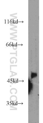 GIRK2 Antibody in Western Blot (WB)
