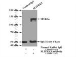 SLITRK3 Antibody in Immunoprecipitation (IP)
