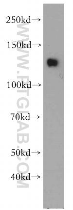 SLITRK3 Antibody in Western Blot (WB)