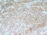 Cardiac Troponin I Antibody in Immunohistochemistry (Paraffin) (IHC (P))