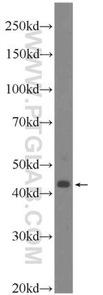 HOXB1 Antibody in Western Blot (WB)