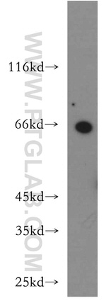 ZNF192 Antibody in Western Blot (WB)