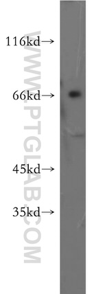 ZNF192 Antibody in Western Blot (WB)