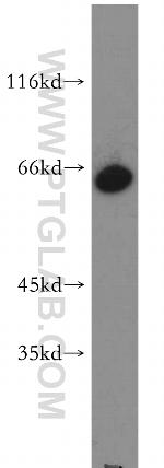 ZNF192 Antibody in Western Blot (WB)