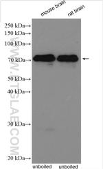 KCNA5 Antibody in Western Blot (WB)