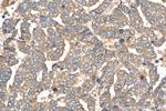 ATP5G3 Antibody in Immunohistochemistry (Paraffin) (IHC (P))