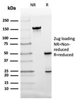 Fatty Acid Binding Protein 4 (FABP4) Antibody in Immunoelectrophoresis (IE)