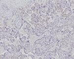Fatty Acid Binding Protein 4 (FABP4) Recombinant Rabbit Monoclonal Antibody (FABP4/9086R)