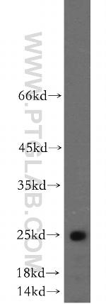 NANOS3 Antibody in Western Blot (WB)