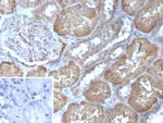 FABP1/Fatty Acid Binding Protein 1 Antibody in Immunohistochemistry (Paraffin) (IHC (P))
