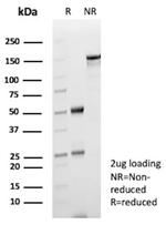 FABP1/Fatty Acid Binding Protein 1 Antibody in SDS-PAGE (SDS-PAGE)