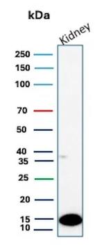 FABP1/Fatty Acid Binding Protein 1 Antibody in Western Blot (WB)