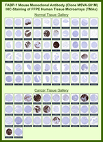 Fatty Acid Binding Protein (Liver)/FABP1 Antibody in Immunohistochemistry (Paraffin) (IHC (P))