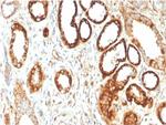 Fatty Acid Binding Protein (Liver)/FABP1 Antibody in Immunohistochemistry (Paraffin) (IHC (P))