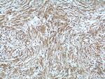 NF2 Antibody in Immunohistochemistry (Paraffin) (IHC (P))