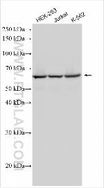 PRMT7 Antibody in Western Blot (WB)