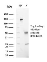FABP2 (Marker of Metastatic Potential in Colorectal Cancer) Antibody in SDS-PAGE (SDS-PAGE)