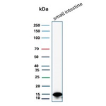 FABP2 (Marker of Metastatic Potential in Colorectal Cancer) Antibody in Western Blot (WB)