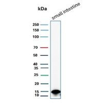FABP2 (Marker of Metastatic Potential in Colorectal Cancer) Antibody in Western Blot (WB)