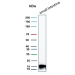 FABP2 (Marker of Metastatic Potential in Colorectal Cancer) Antibody in Western Blot (WB)
