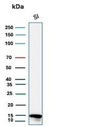 FABP2 (Marker of Metastatic Potential in Colorectal Cancer) Antibody in Western Blot (WB)