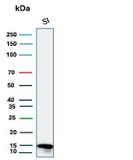 FABP2 (Marker of Metastatic Potential in Colorectal Cancer) Antibody in Western Blot (WB)