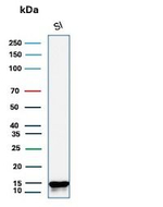 FABP2 (Marker of Metastatic Potential in Colorectal Cancer) Antibody in Western Blot (WB)