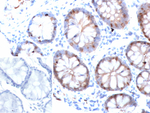 FABP2 (Marker of Metastatic Potential in Colorectal Cancer) Monoclonal Antibody (FABP2/6936)