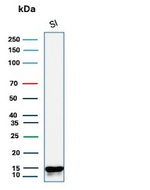 FABP2 (Marker of Metastatic Potential in Colorectal Cancer) Antibody in Western Blot (WB)