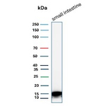 FABP2 (Marker of Metastatic Potential in Colorectal Cancer) Antibody in Western Blot (WB)