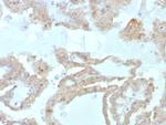 FABP2 (Marker of Metastatic Potential in Colorectal Cancer) Monoclonal Antibody (FABP2/7669)