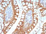 FABP2 (Marker of Metastatic Potential in Colorectal Cancer) Monoclonal Antibody (FABP2/7670)