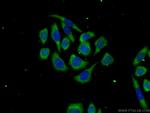 TTC31 Antibody in Immunocytochemistry (ICC/IF)