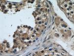 TTC31 Antibody in Immunohistochemistry (Paraffin) (IHC (P))