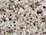 SMC1A Antibody in Immunohistochemistry (Paraffin) (IHC (P))