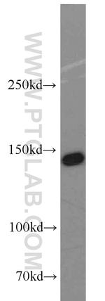SMC1A Antibody in Western Blot (WB)