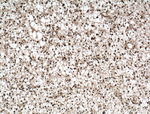SMC1A Antibody in Immunohistochemistry (Paraffin) (IHC (P))