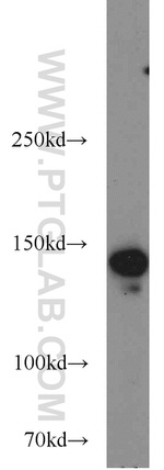 SMC1A Antibody in Western Blot (WB)