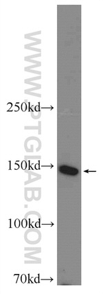 SMC1A Antibody in Western Blot (WB)